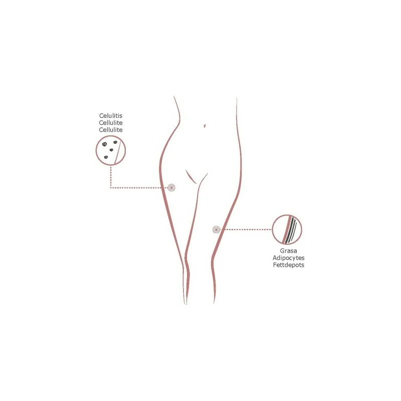 Pack Anti-Cellulite Mesothérapie - Institute BCN Packs - Soin Esthétique - Institute BCN Packs - Mésothérapie